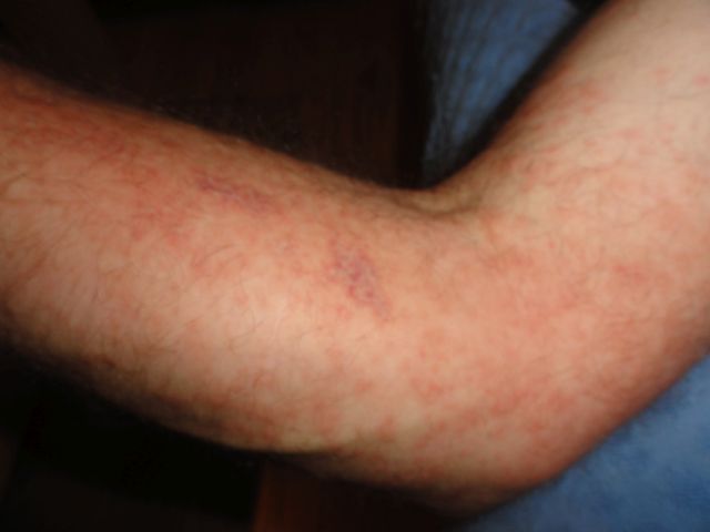 Gosenice borovega prelca